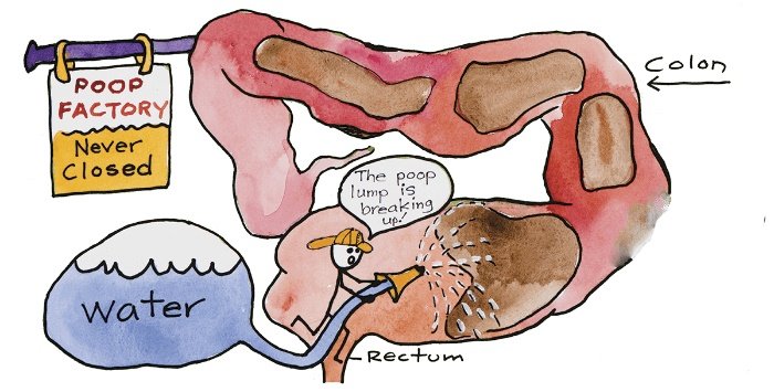 Colon hydrotherapy treatment in progress with observation screen