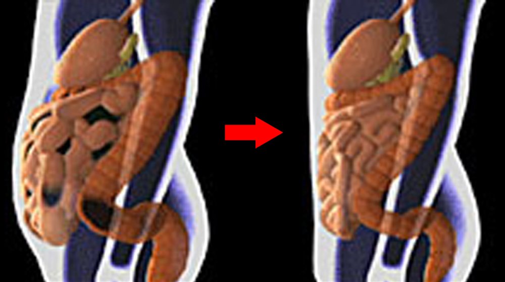 colonic machine price buyer intent showing procurement decision makers reviewing specifications