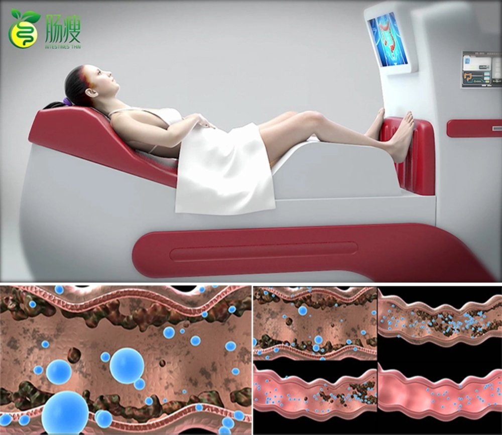 Medical team preparing patient for surgical procedure using colonic machine