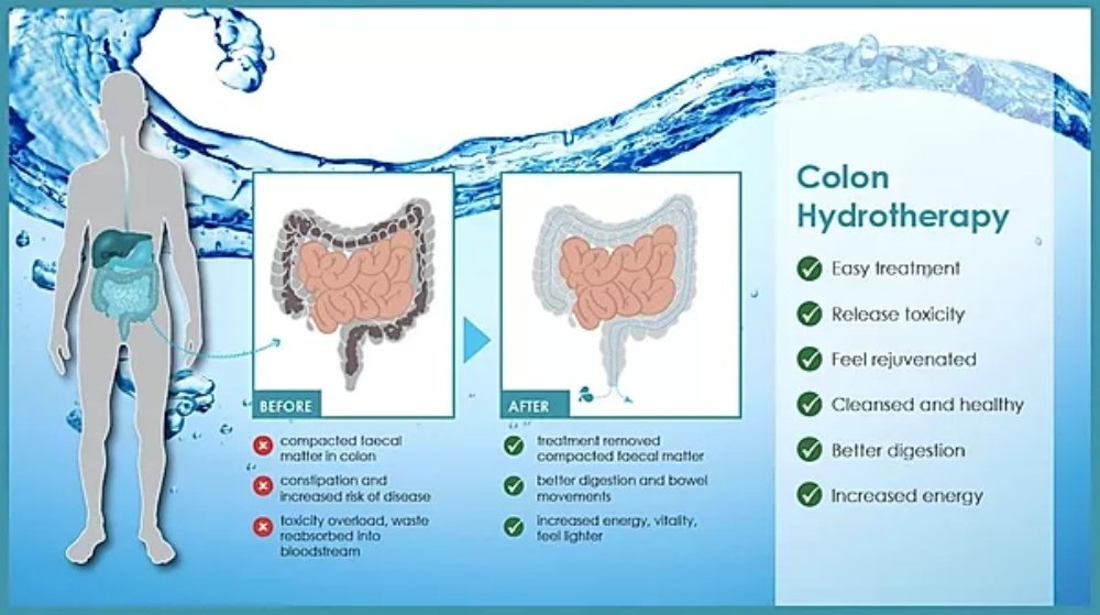 What Nutrition Centers in the U.S. Should Know When Researching the Colon Hydrotherapy Market — colon hydro gerät preis，colon hydro therapie geräte preise (12).JPG